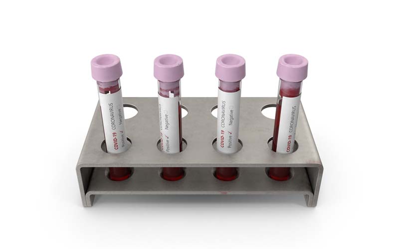 طرح گرافیکی شیشه های آزمایش خون