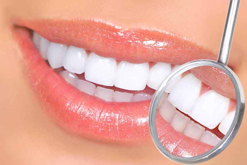 عکس لارج فرمت از لبخند و دندان های سالم